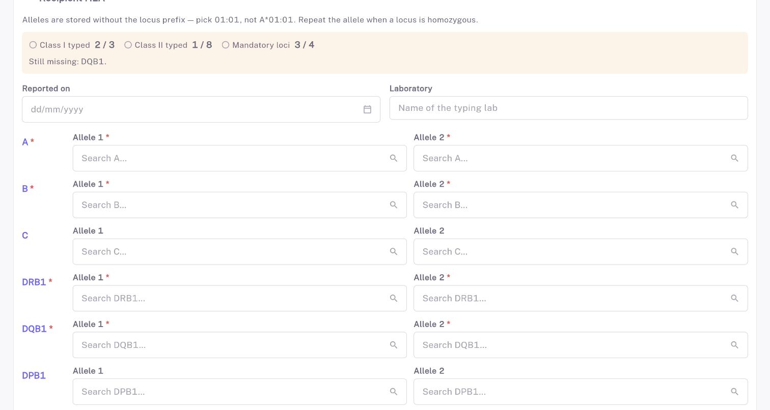 The HLA typing grid: eleven loci with two searchable allele fields each.